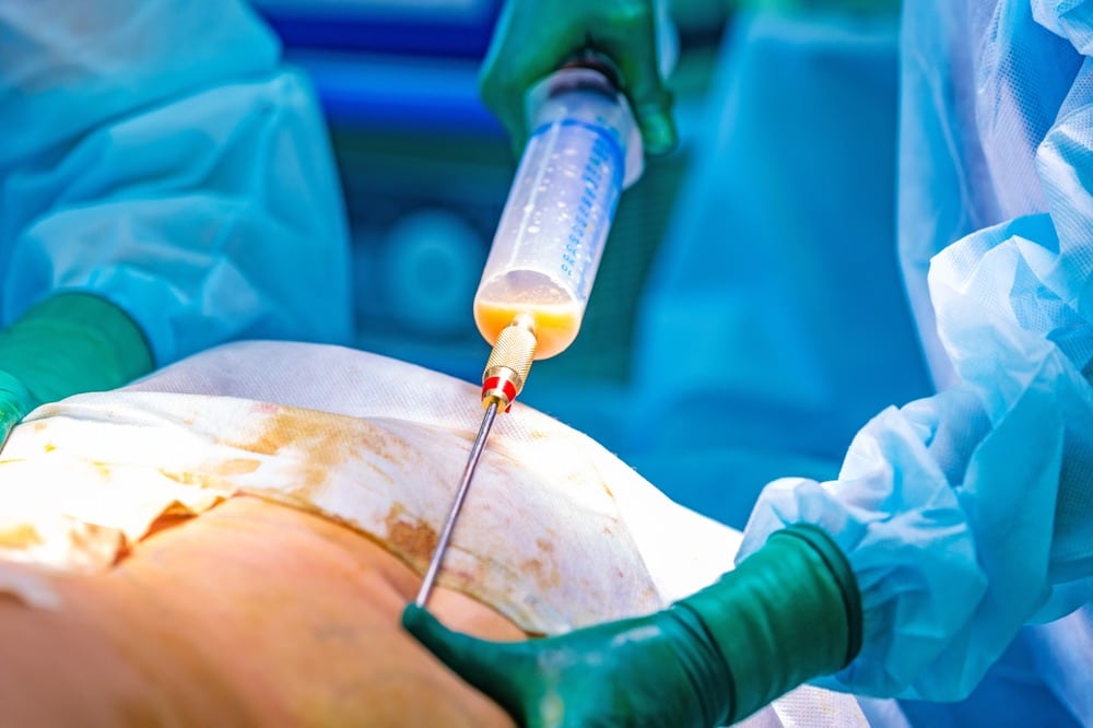 Manual Lymphatic Drainage